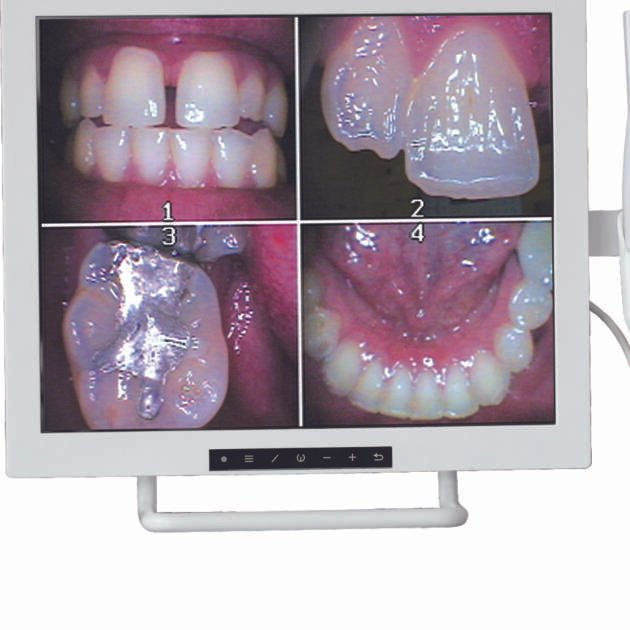 Plastic Set Up Trays - Pink (20 ct)